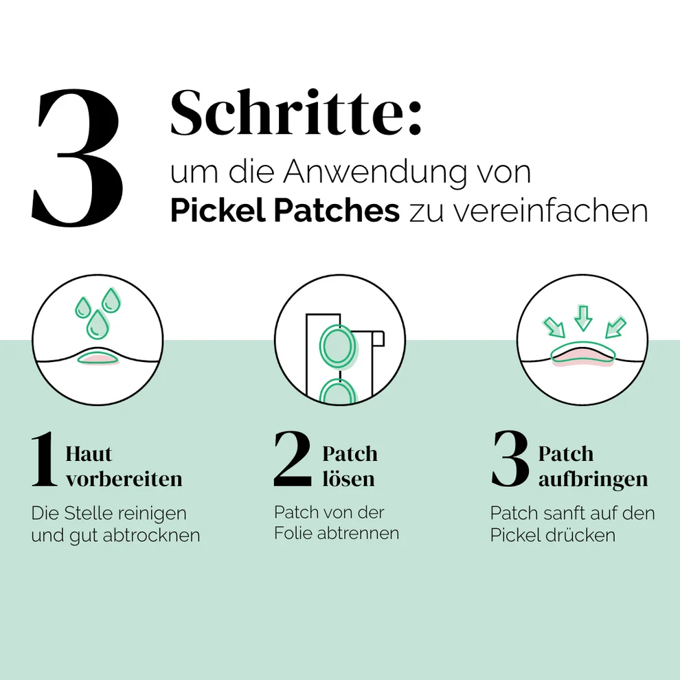 Atamé SOS - Soforthilfe Pickel Patches Spezial - 30 Patches